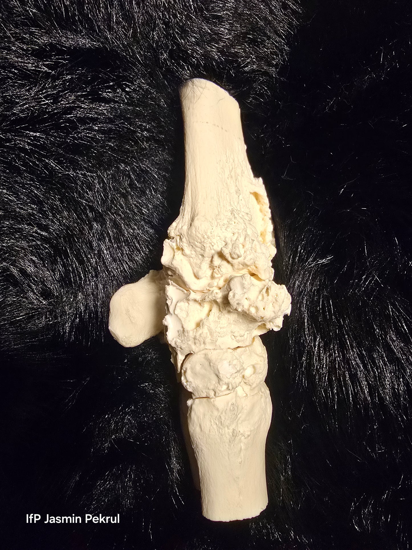 Veganatomie Karpalgelenksarthrose